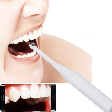 New HD USB Visual Dental Appliance